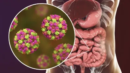 Alerta sanitaria por casos de norovirus en Punta Arenas y Puerto Natales